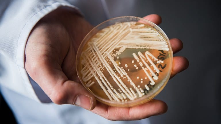 Zahl der Pilzinfektionen mit dem Hefepilz Candida auris hat sich 2023 versechsfacht. Ein Problem sind die zunehmenden Resistenzen gegen den Hefepilz. Was tun? Ein gespräch mit Alexander Aldejohann. 